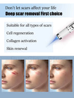 Solve Scar Problem Top Selling