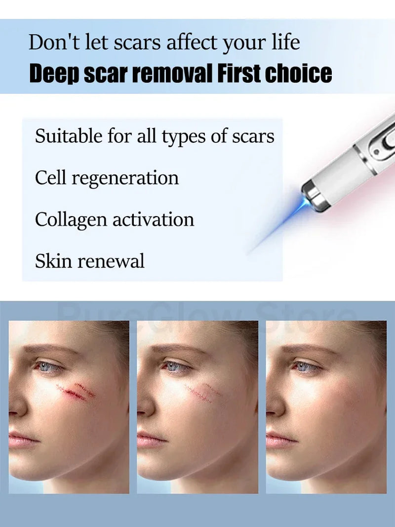 Solve Scar Problem Top Selling