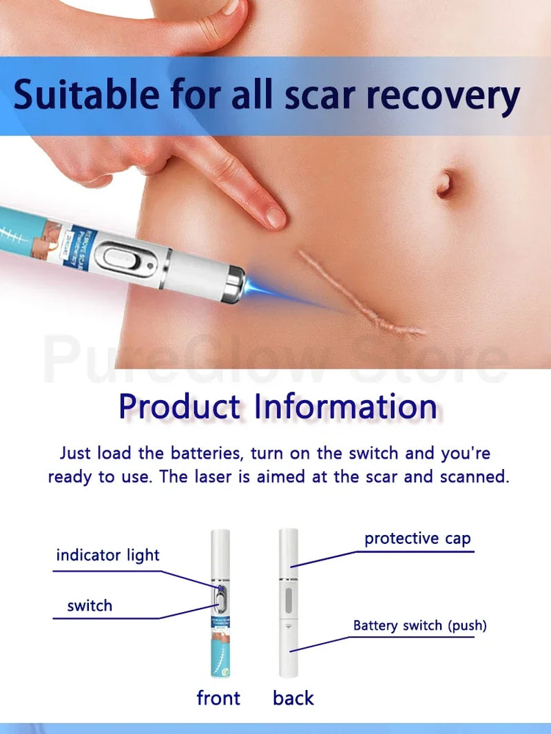 Solve Scar Problem Top Selling