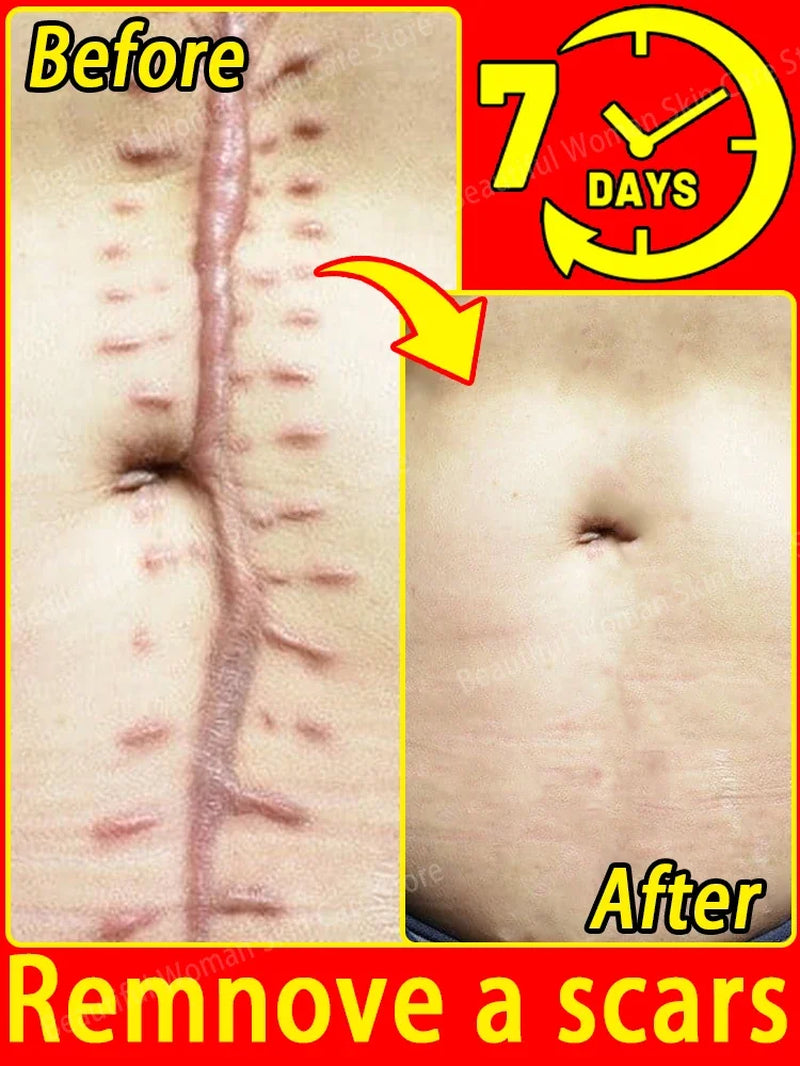 Solve Scar Problem Top Selling