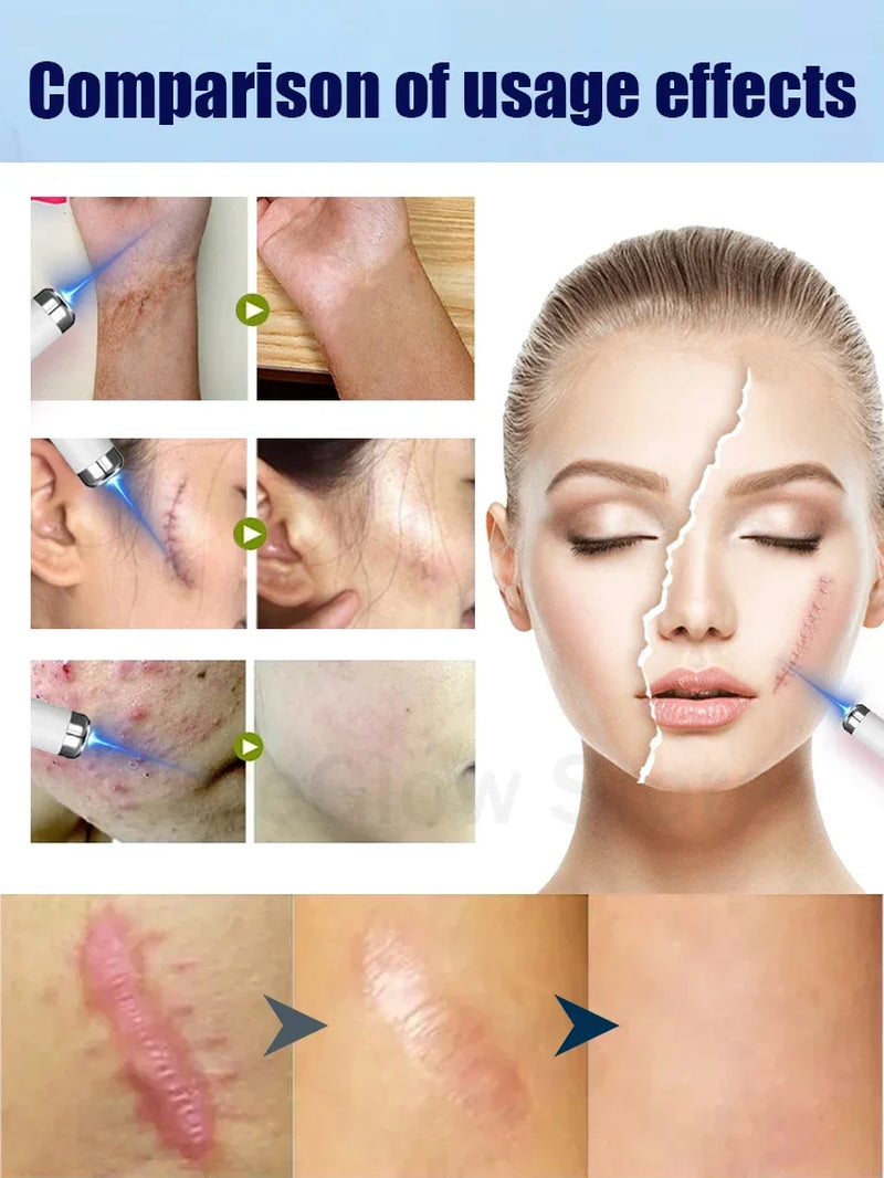 Solve Scar Problem Top Selling