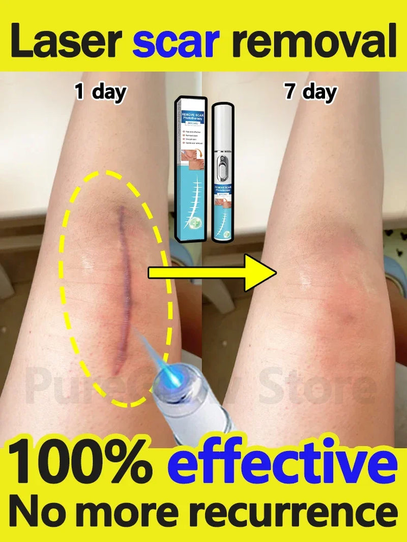 Solve Scar Problem Top Selling